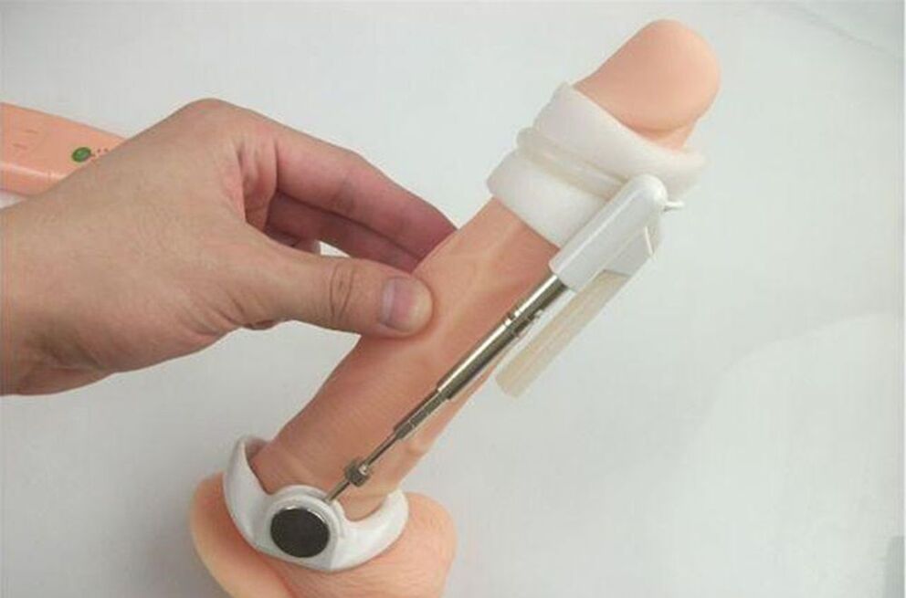 extender untuk pembesaran penis